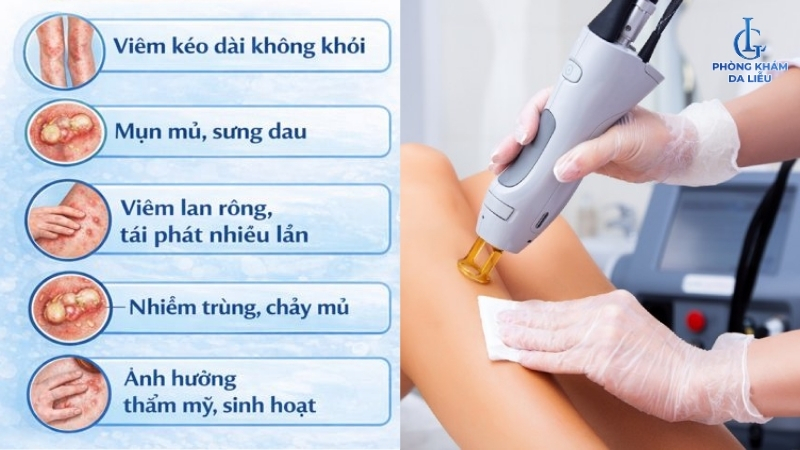 da chân bị viêm lỗ chân lông