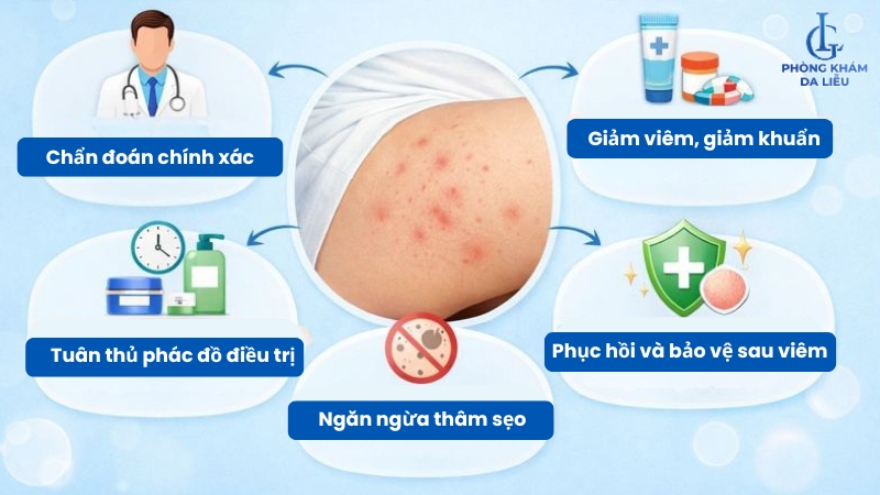 nguyên tắc trị viêm nang lông đùi