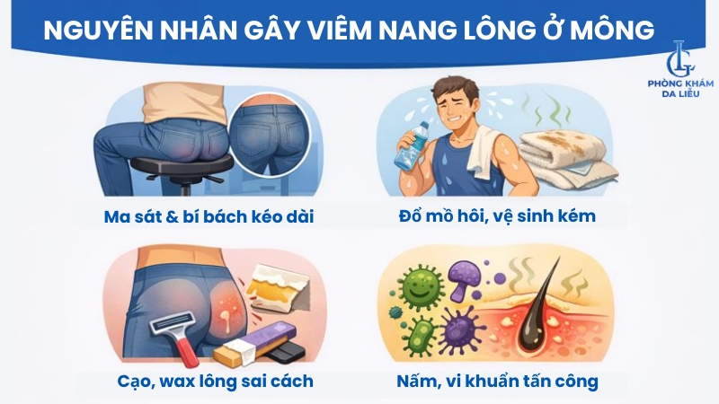 nguyên nhân viêm nang lông ở mông
