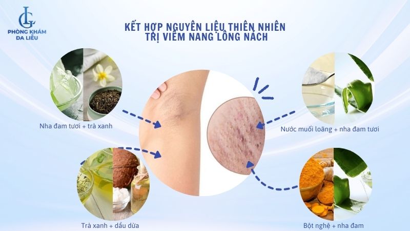 trị viêm nang lông nách tại nhà