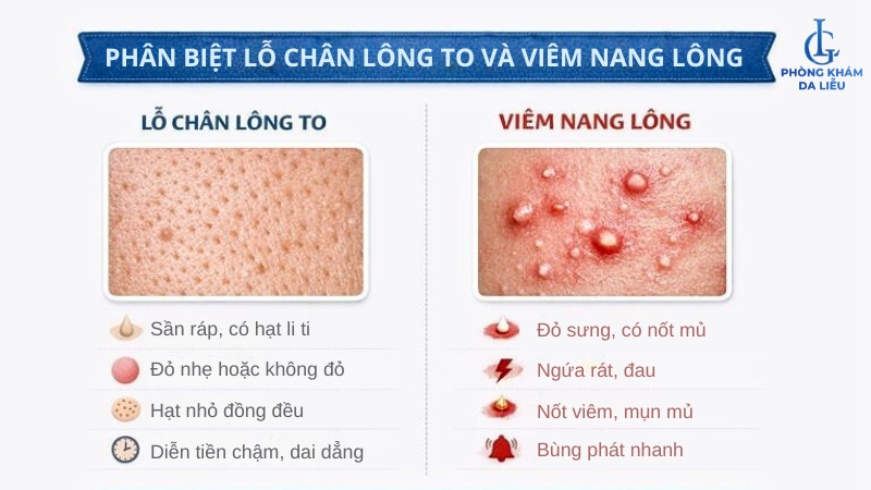 viêm nang lông tay