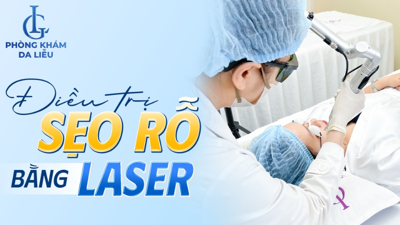 Điều trị sẹo rỗ bằng laser