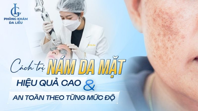 cách trị nám da mặt