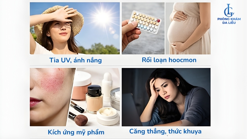 cách trị nám hiệu quả nhất hiện nay