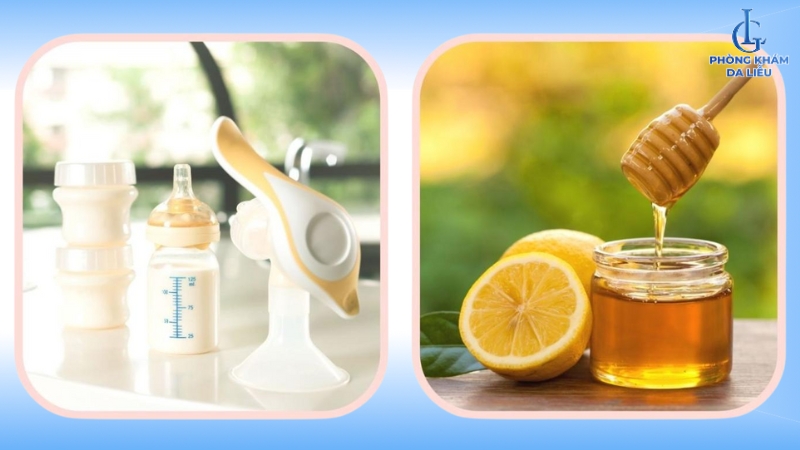 Cách trị nám sau sinh tại nhà