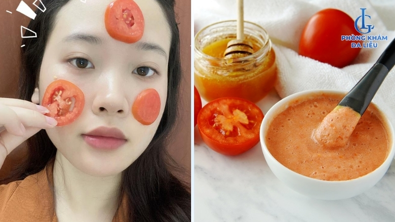 đắp cà chua trị nám mảng