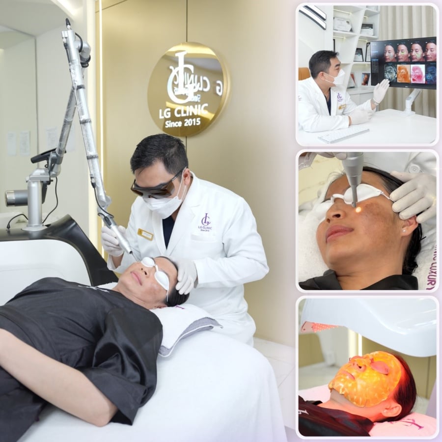 điều trị nám bằng laser