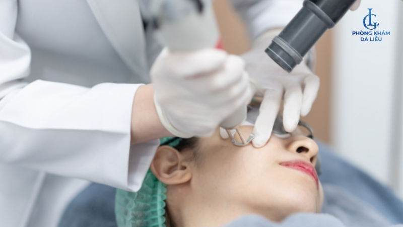 điều trị nám bằng phương pháp nào tốt nhất