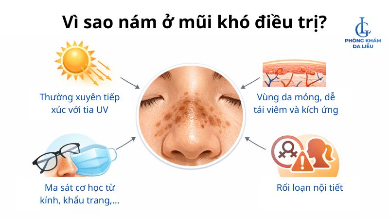 nám ở mũi