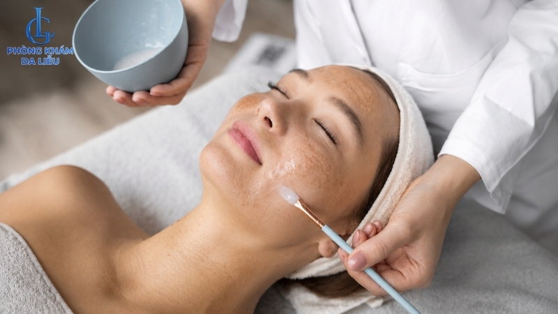 peel da trị nám là gì
