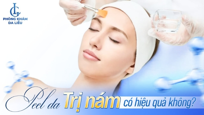 peel da trị nám