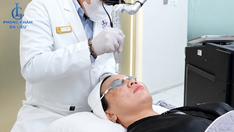 Bác sĩ da liễu sử dụng laser trong điều trị nám da