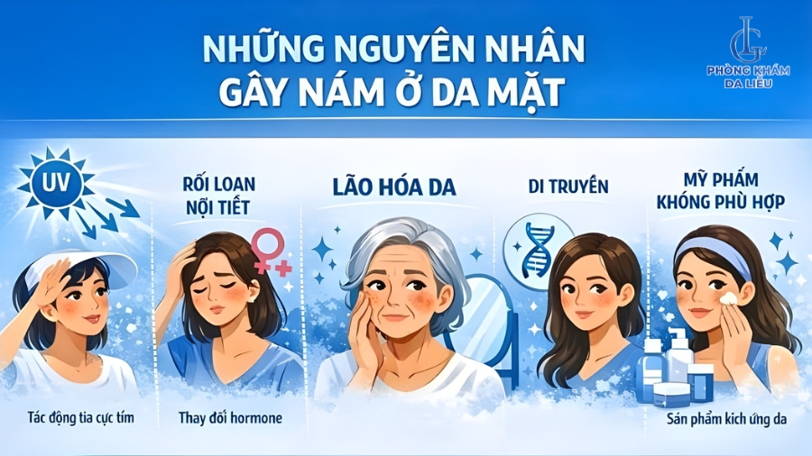 Nguyên nhân gây nám da ở mặt