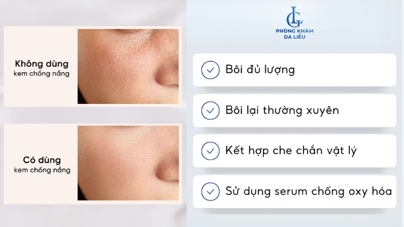 trị nám tàn nhang