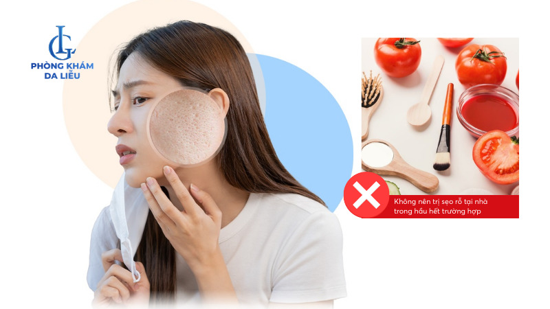 trị sẹo rỗ do mụn