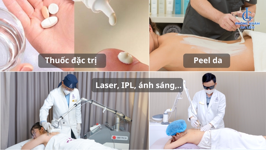 viêm lỗ chân lông có tự hết không