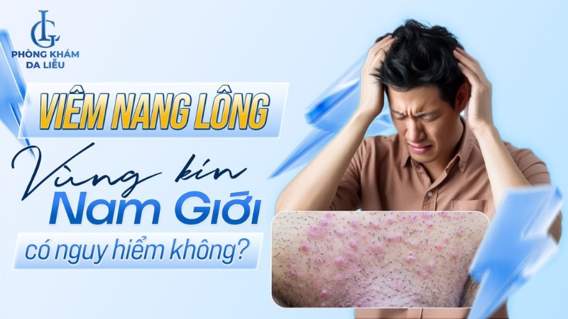 viêm nang lông vùng kín nam giới