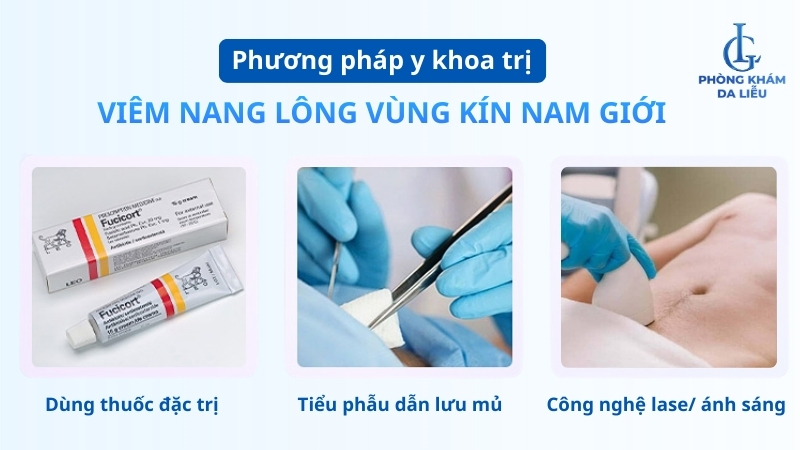 viêm nang lông vùng kin nam giới