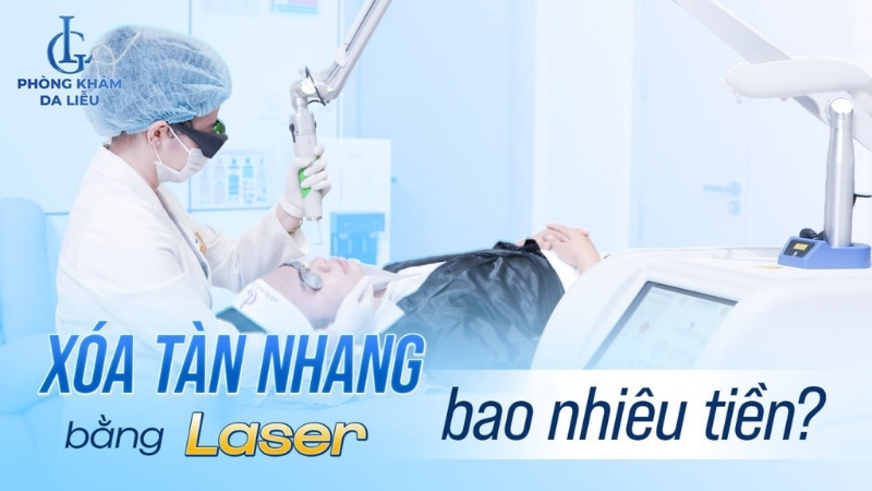 xóa tàn nhang bằng laser bao nhiêu tiền