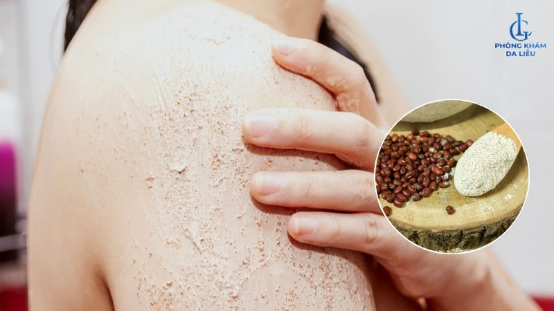 bột đậu đỏ điều trị viêm nang lông