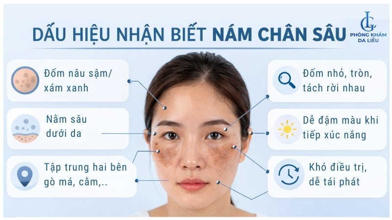 cách trị nám chân sâu