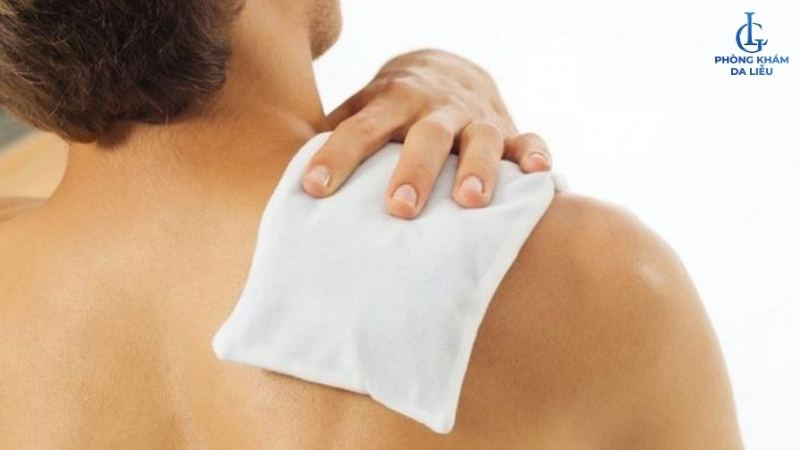 cách xử lý viêm nang lông sau khi wax lông