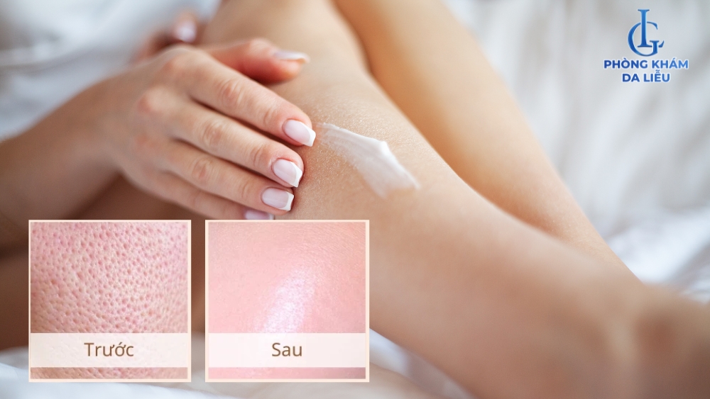 điều trị lỗ chân lông to ở chân