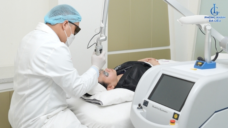 điều trị nám bằng laser pico