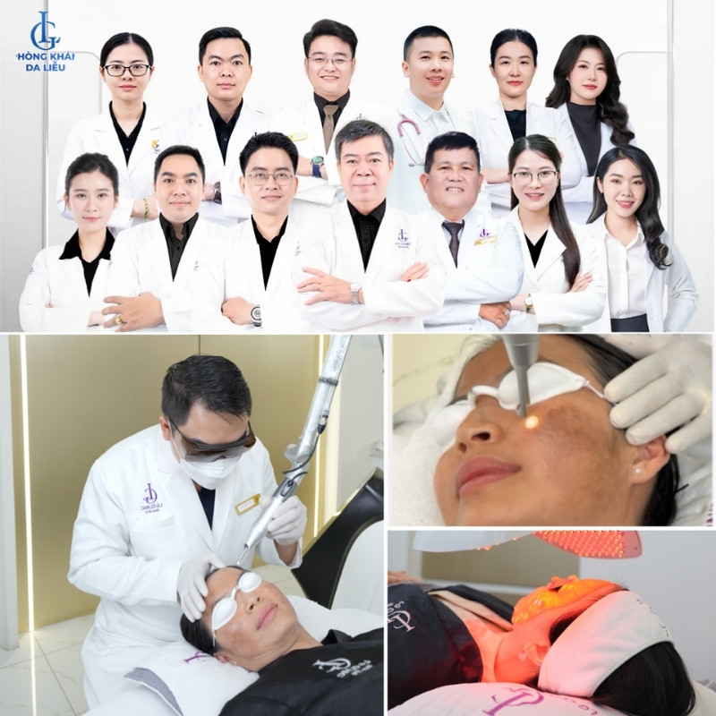 điều trị nám mảng và nám chân sâu