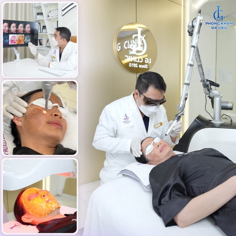 điều trị nám sau sinh