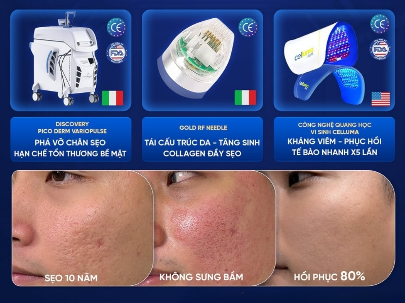 điều trị sẹo đáy tròn bằng triple treatment