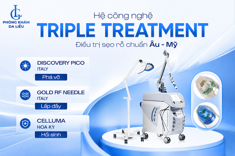 Công nghệ trị sẹo rỗ đáy nhọn triple treatment