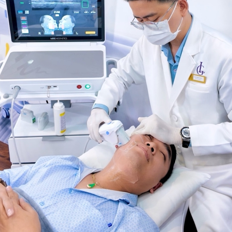 điều trị sẹo rỗ đáy vuông bằng laser fractional co2