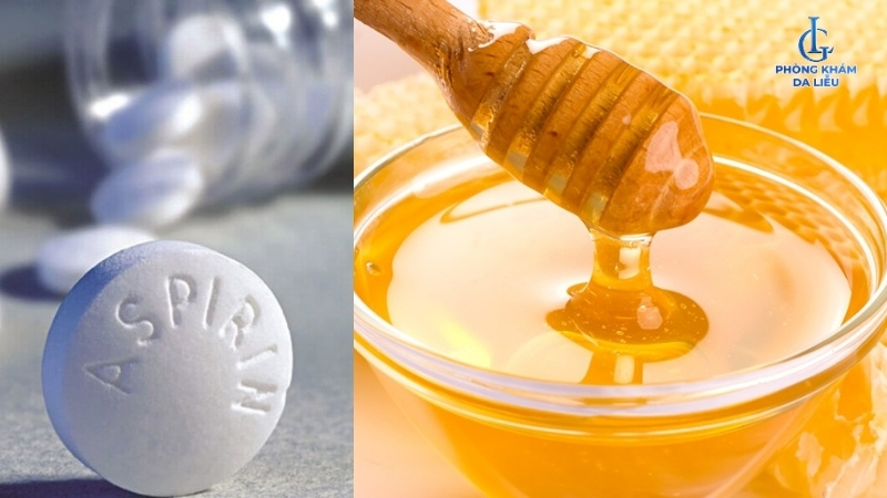 điều trị viêm nang lông bằng aspirin kết hợp mật ong