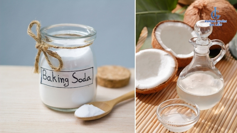 điều trị viêm nang lông bằng dầu dừa và baking soda