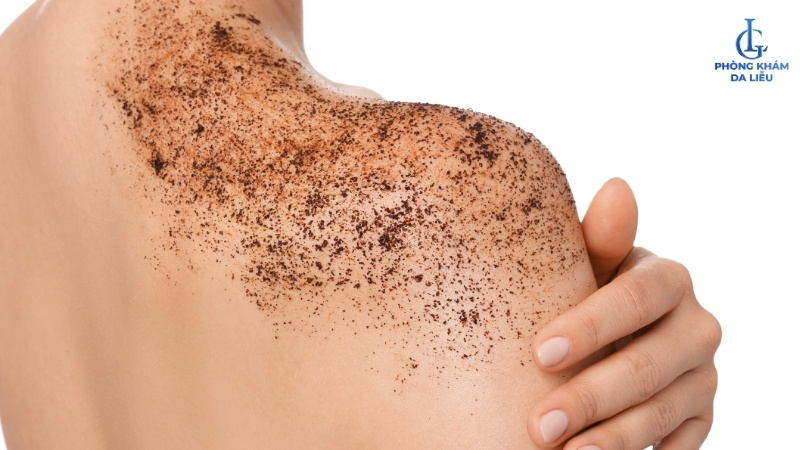 dùng bả cà phê nguyên chất trị viêm nang lông