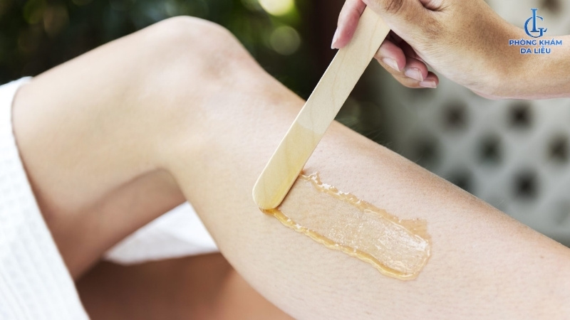 lưu ý trách viêm nang lông sau khi wax lông tại nhà