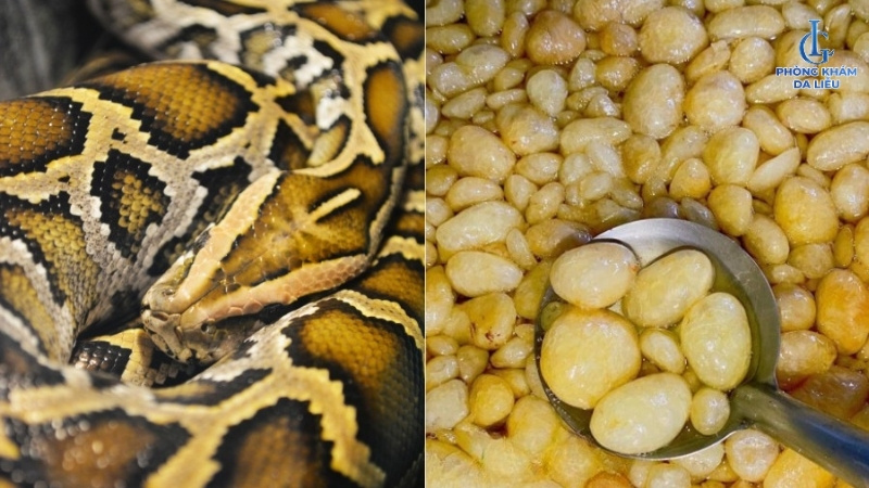 mỡ trăn trị viêm nang lông