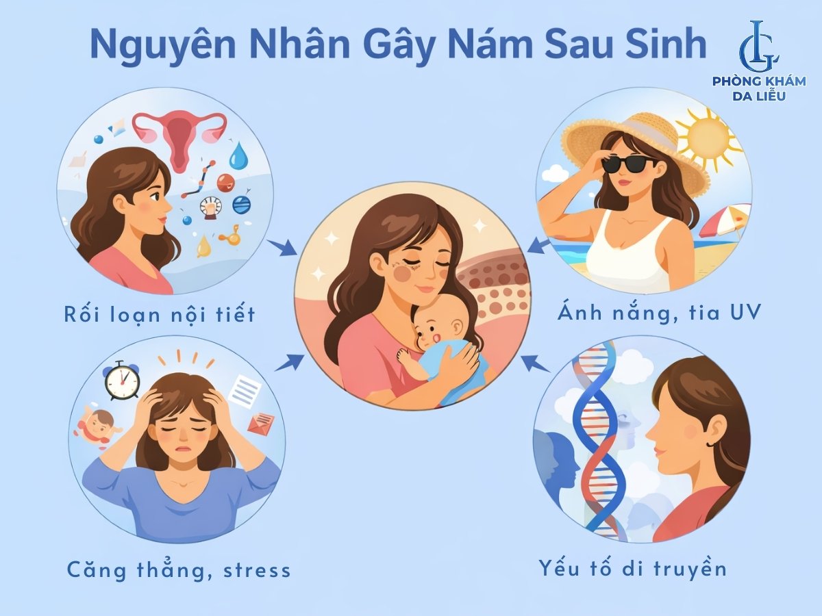 nám sau sinh có tự hết không