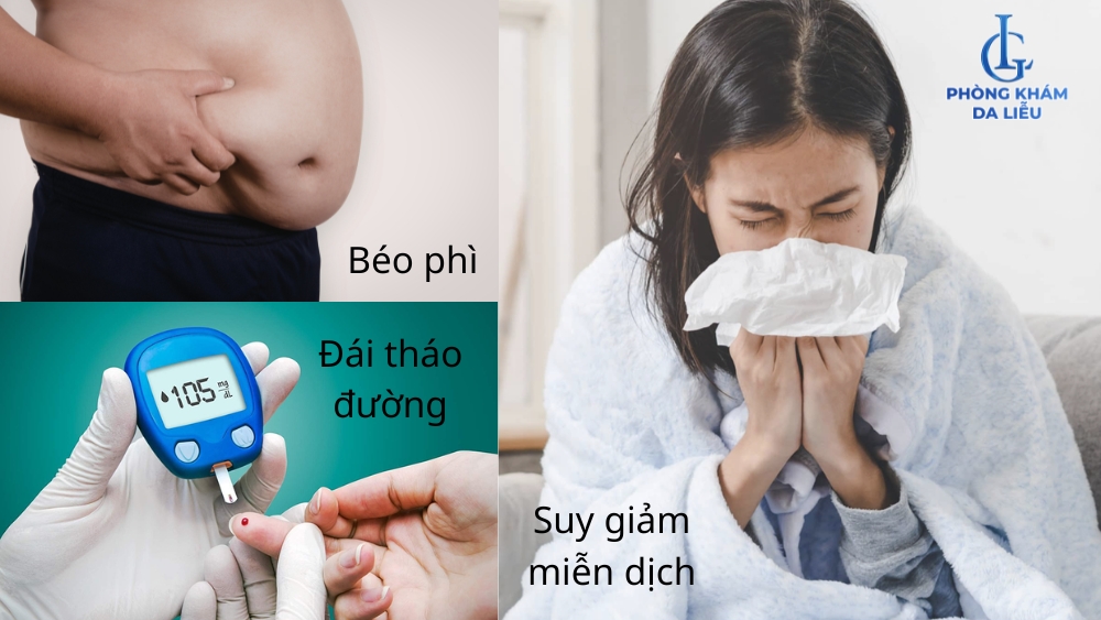 nguyên nhân gây viêm nang lông ở hậu môn