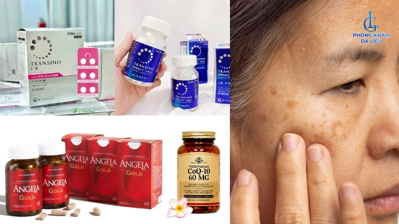 thuốc trị nám chân đinh