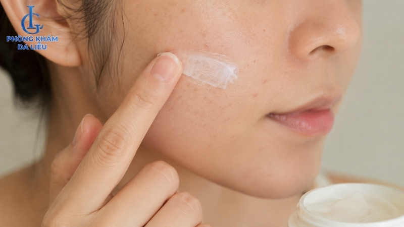 trị nám bằng thuốc bôi
