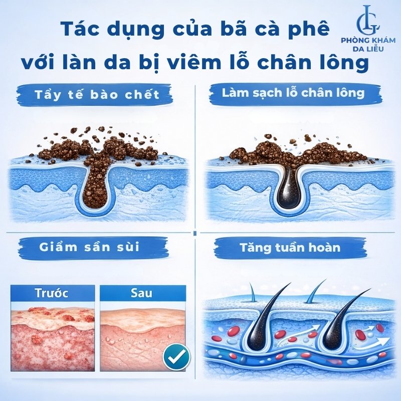 trị viêm lỗ chân lông bằng bã cà phê