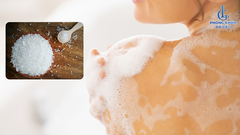 trị viêm nang lông bằng muối tắm và sữa tắm