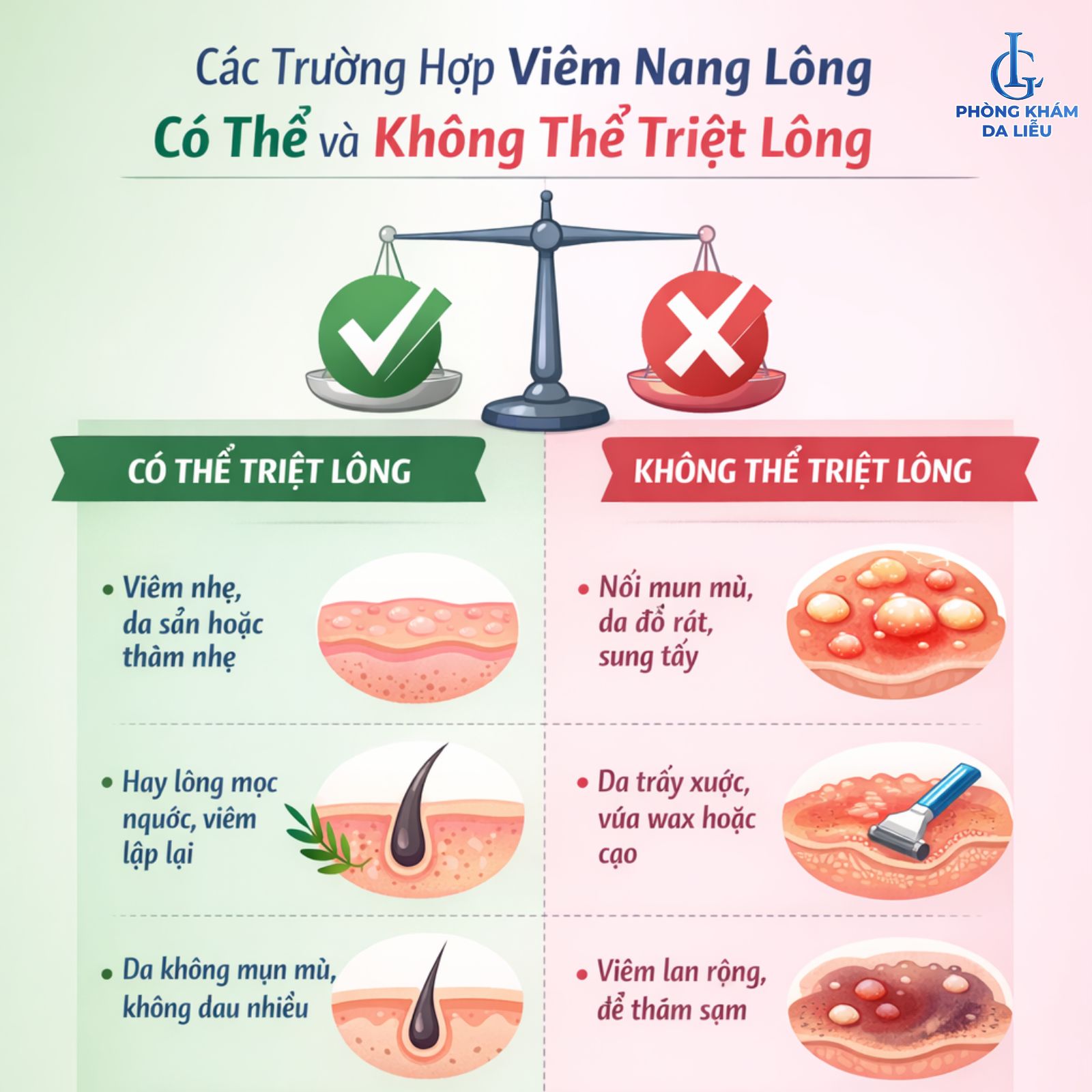 viêm nang lông có nên triệt lông hay không