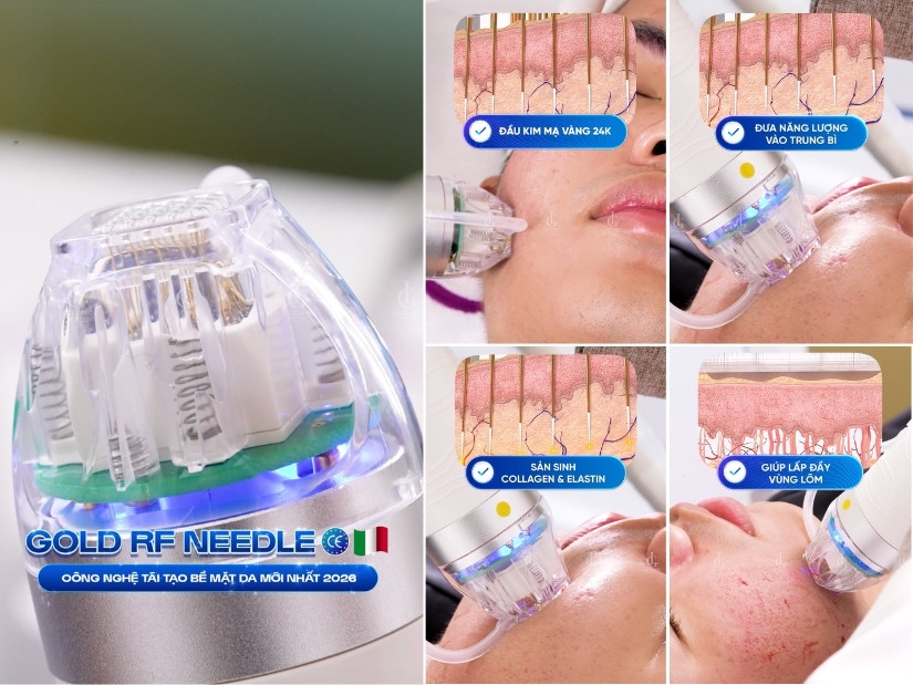 Cơ chế tác động của Gold RF Needle