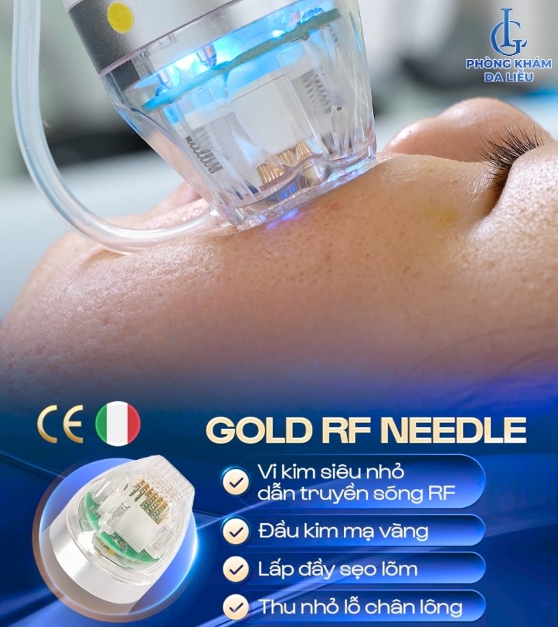Gold rf needle