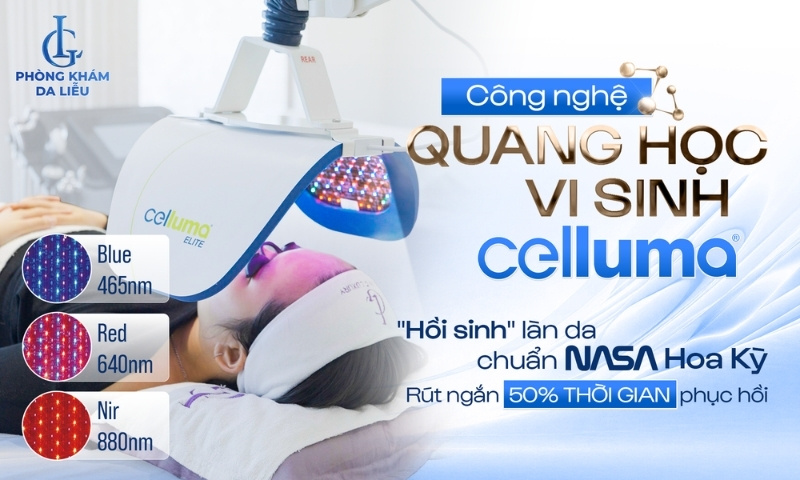 Công nghệ trị sẹo rỗ