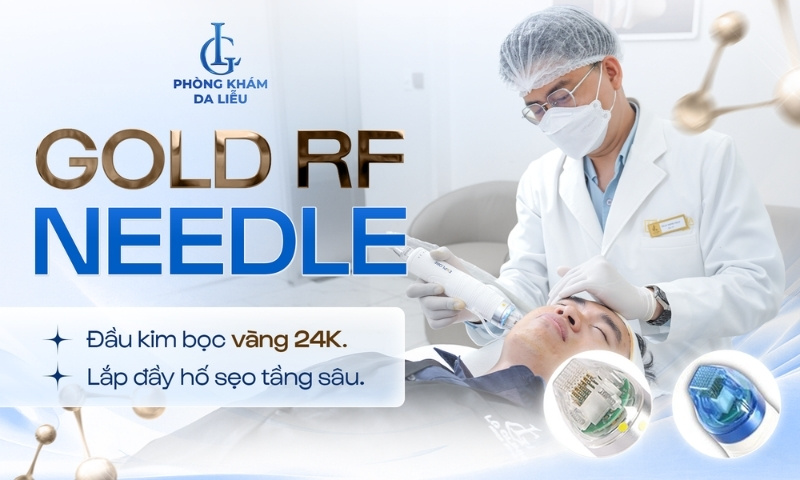 Công nghệ trị sẹo rỗ