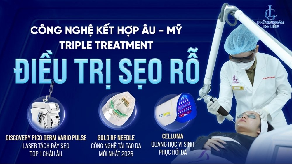 Triple Treatment trị sẹo rỗ